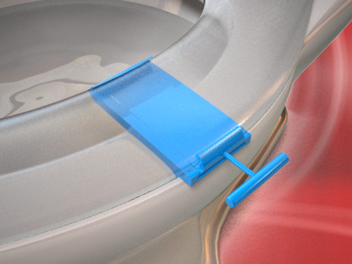 Toilet Seat Lifting Device