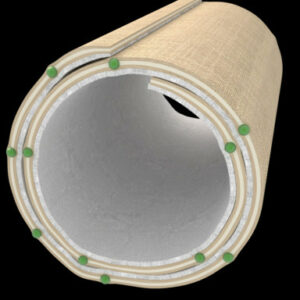 Splinted Compression Bandages