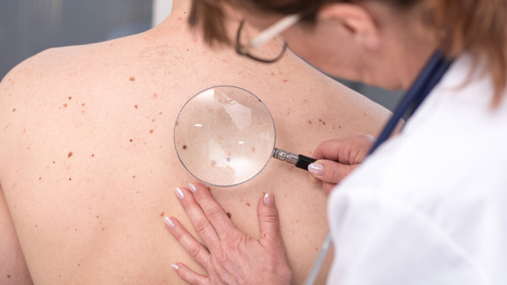 Skin Care Phone Attachment