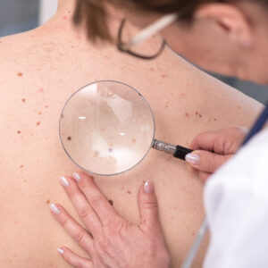 Skin Care Phone Attachment