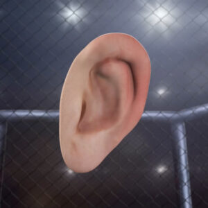 The Original Cauliflower Ear